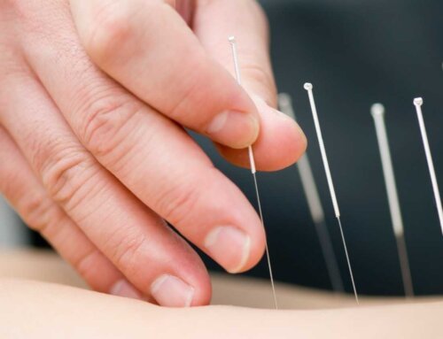Ürtiker müalicəsində akupunkturun yeri varmı?