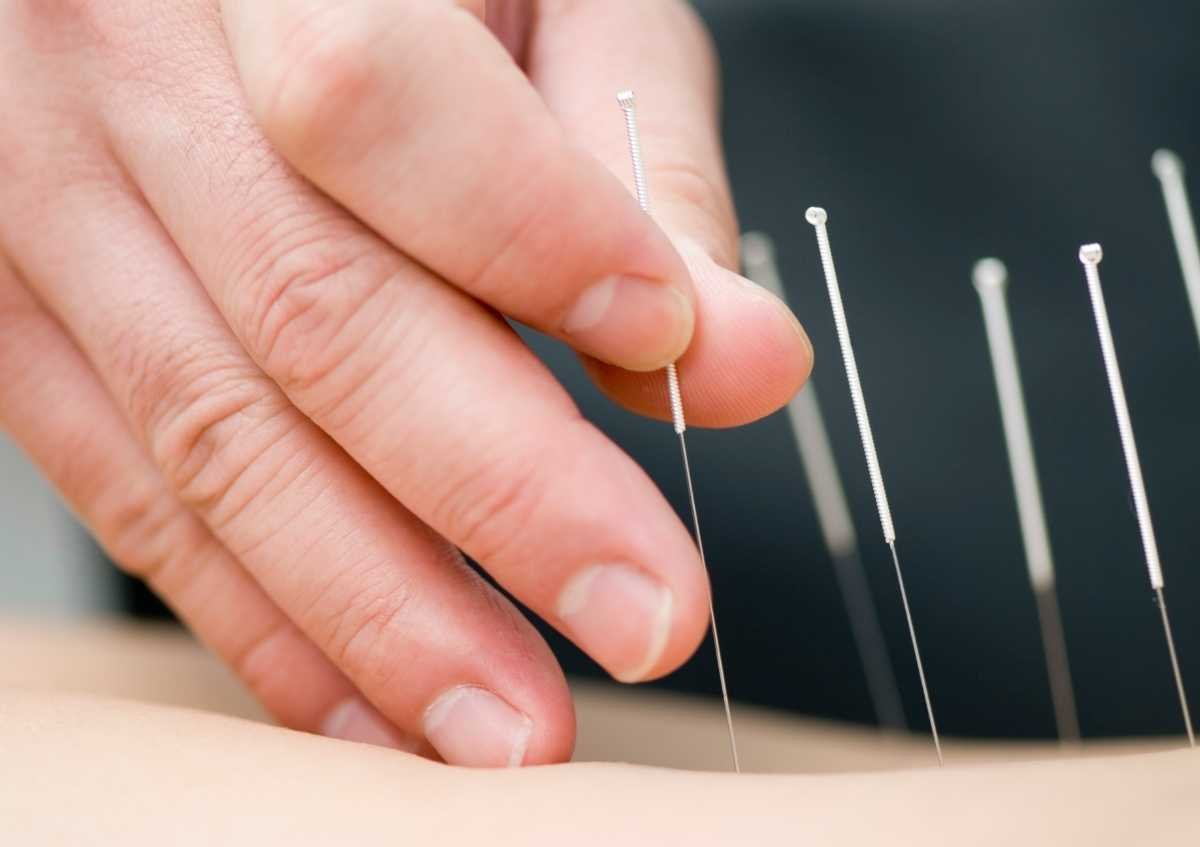 Ürtiker Tedavisinde Akupunkturun Yeri Var Mı