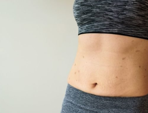 Lichen Planus nədir? Semptomlar və necə müalicə etmək olar?