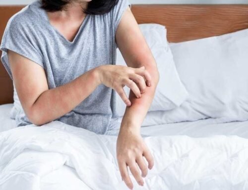 Alergiya və immun sistem xəstəlikləri arasında əlaqə varmı?