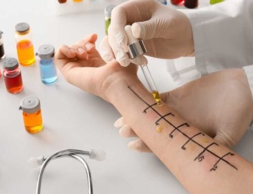 Alergiyanın diaqnozu necə qoyulur? Hansı testlər etibarlıdır?